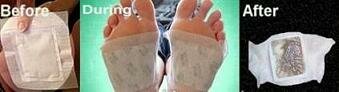 Japanese Chikusaku Detox Foot Pads