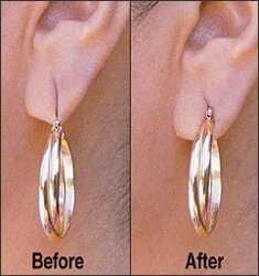 Lobe Wonder Support Patches 